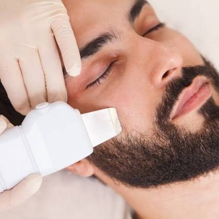 Mesoterapia Facial Vitamínica